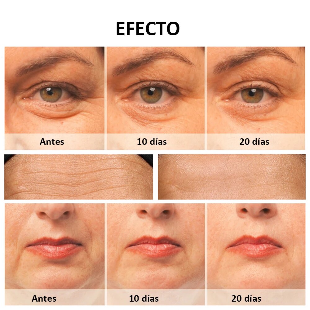 Masajeador Facial Antiarrugas / Fototerapia