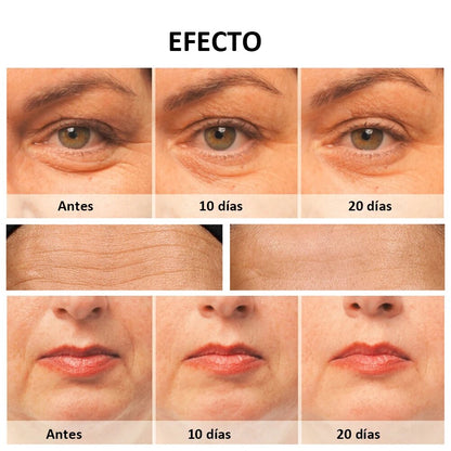 Masajeador Facial Antiarrugas / Fototerapia